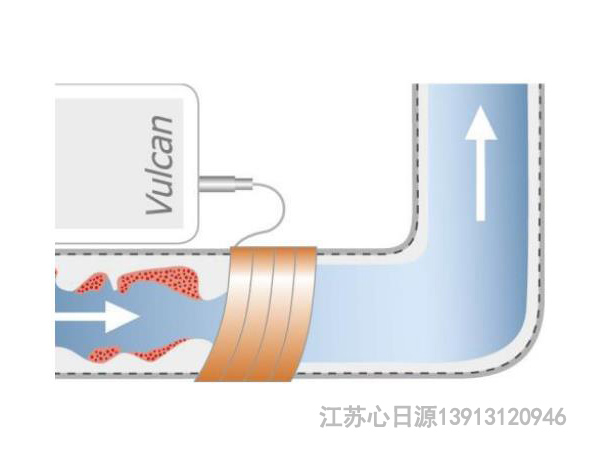 沃肯第二种功效除垢除菌